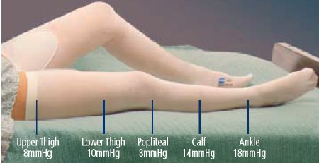 Cardinal Anti-embolism Stocking T.E.D.™ Thigh High 2X-Large / Short White Inspection Toe - CT/6 - 3183LF-CT