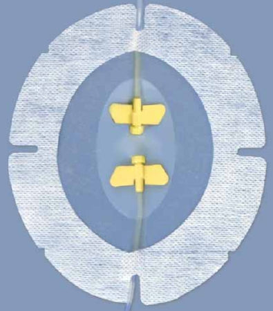 Medline Port Window Dressing SecureView Film 5-1/2 X 6-1/2 Inch Sterile - Case of 50 - SCVP66XT-CS
