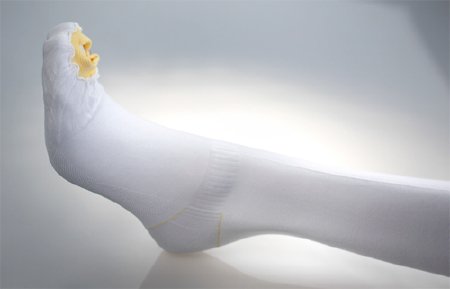 Alba Healthcare Anti-embolism Stocking UltraCARE® Thigh High 2X-Large / Long White Inspection Toe - Case of 12 - 873-05-CS