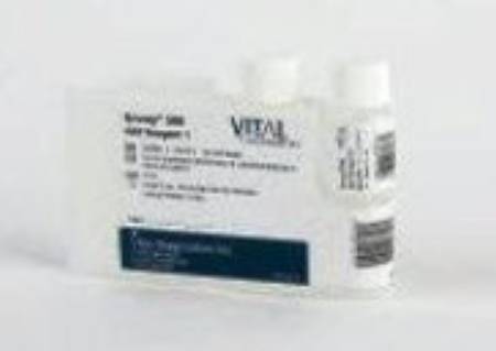 Elitech Group Inc Reagent Kit Envoy® General Chemistry Total Iron For Envoy 500+ Chemistry System 720 Tests R1: 8 X 27 mL, R2: 8 X 7 mL - Each - 55360-EA