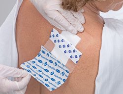 Hartmann Transparent Film Dressing Hydrofilm® 6 X 8 Inch 4 Tab Delivery Rectangle Sterile - Each - 685761-EA