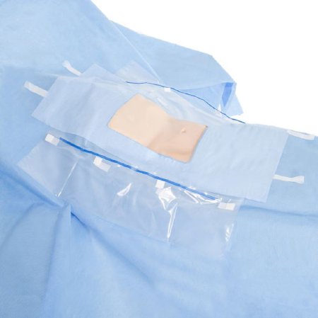 O&M Halyard Inc Abdominal Drape Laparoscopic / Cholecystectomy Drape 104 W X 76 W X 102 L Inch Sterile - Case of 25 - 89538-CS