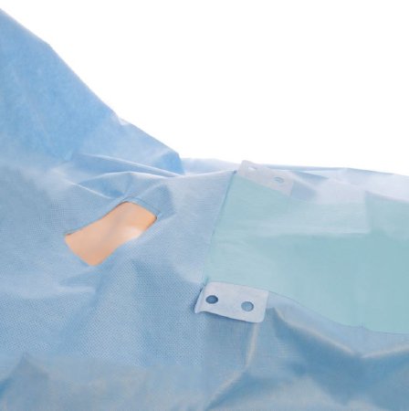 O&M Halyard Inc EENT Drape Thyroid Drape 76 W X 124 L Inch Sterile - Case of 20 - 89539-CS