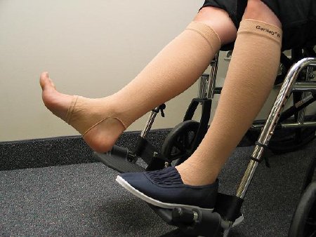 Prevent Products Leg Sleeve GeriLeg® 2X-Large - Pair - 20-500-PR