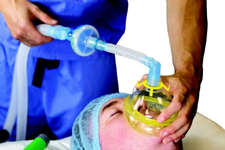 Flexicare Flexicare® Anesthesia Breathing Circuit Corrugated Tube 40 Inch Tube Dual Limb Adult 3 Liter Bag Single Patient Use - Case of 20 - 038-01-600U-CS