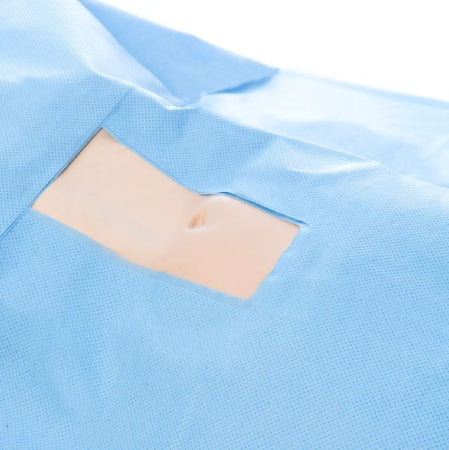 O&M Halyard Inc Surgical Drape Halyard Univesal U-Drape 76 W X 120 L Inch NonSterile - Case of 190 - 13231NS-CS