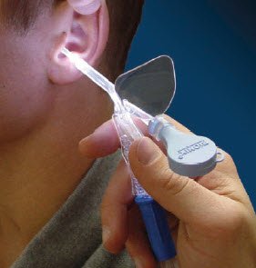 Bionix Vacuum Aspiration Kit Lighted Ear Curette™ - Case of 25 - 2625-CS