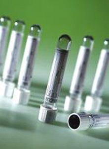 Greiner Bio-One VACUETTE® Z Serum Sep Clot Activator Venous Blood Collection Tube Serum Tube Clot Activator / Separator Gel Additive 13 X 100 mm 5 mL Gold / Black Ring Pull Cap Polyethylene Terephthalate (PET) Tube - Box of 50 - 456018P-BX