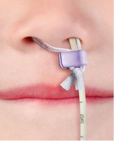 Applied Medical Technologies Spare Clip AMT Micro Bridle™ 18 Fr. - Box of 5 - 4-4518-BX