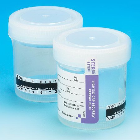 Globe Scientific Specimen Container with Temperature Strip 57 X 73 mm 90 mL (3 oz.) Screw Cap Patient Information Sterile - Case of 300 - 6236-CS