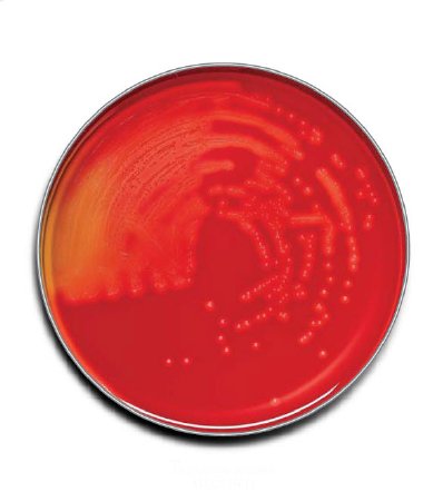 BD Prepared Media BD BBL™ Trypticase™ Soy Agar with 5% Sheep Blood (TSA II™) Dark Red Mono-Plate Format - Box of 100 - 221261-BX