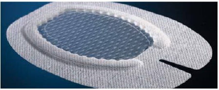 Medline Window Dressing Sorbaview Ultimate Fabric / Film 3-3/4 X 5-1/8 Inch Sterile - Case of 100 - SV41UDXT-CS