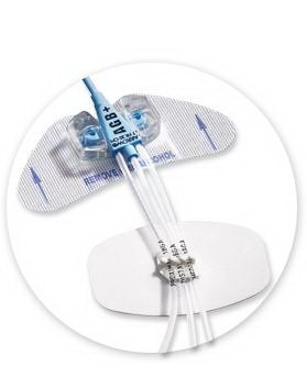 BD Catheter / Line Securement Device StatLock® CV Plus - Case of 25 - CV0223-CS