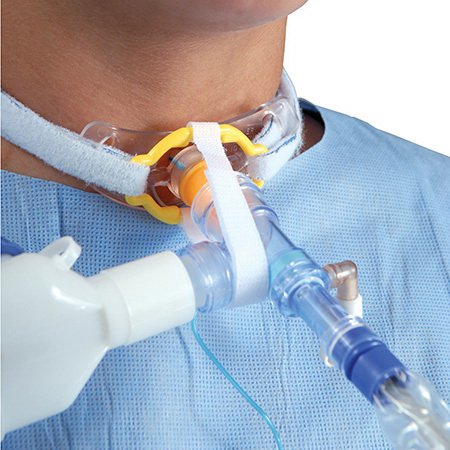 Tri-Anim Health Services Tracheotomy Antidisconnect Device TrachStay™ - Case of 50 - 103-11270EA-CS