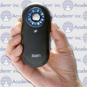 Acuderm Dermatoscope Dermlite® Carbon® - Each - 3GENCARBON-EA