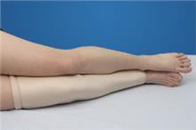 Alimed Leg Tube DermaSaver™ Medium - Each - 2970006291-EA