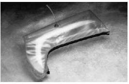 Allied Healthcare Schuco® Air Splint Kit Inflatable Nylon / PVC / Vinyl Clear - Each - S520-EA
