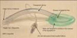 Ambu Straight Laryngeal Mask AuraOnce™ 30 mL Cuff Size 4 Single Patient Use - Case of 10 - 341400000-CS