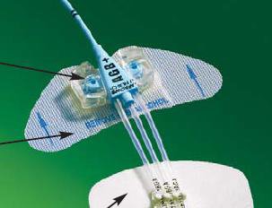 BD Catheter / Line Securement Device StatLock® CV Plus - Box of 25 - CV0224-BX