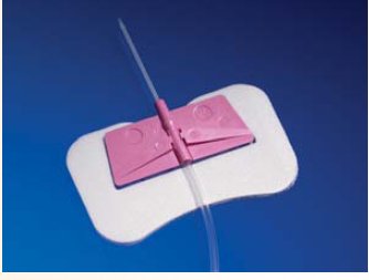 BD Catheter / Line Securement Device Statlock® Intima™ Plus - Box of 50 - VIFP4-BX