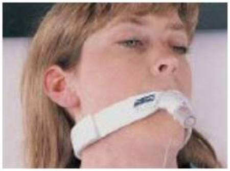 Bird & Cronin Endotracheal Tube Holder Endo-MATE™ Adult - Each - 08148115-EA