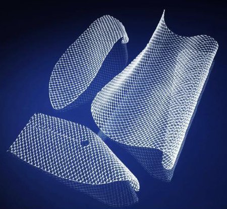 Davol Inguinal Hernia Repair Mesh Bard® Soft Mesh Nonabsorbable Polypropylene Monofilament 6 X 6 Inch Square Style Sterile - Case of 3 - 0117011-CS