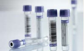 Greiner Bio-One VACUETTE® Venous Blood Collection Tube Whole Blood Tube K3 EDTA Additive 13 X 75 mm 4 mL Lavender / Black Ring Pull Cap Polyethylene Terephthalate (PET) Tube - Box of 50 - 454021-BX
