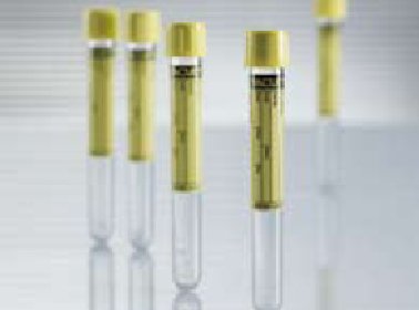 Greiner Bio-One VACUETTE® Urinalysis Tube Conical Bottom Plain 16 X 100 mm 9.5 mL Yellow Pull Cap Polyethylene Terephthalate (PET) Tube - CA/1200 - 455028-CA