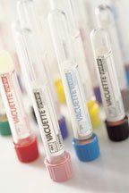 Greiner Bio-One VACUETTE® Venous Blood Collection Tube K2 EDTA Additive 13 X 100 mm 6 mL Lavender / Black Ring Pull Cap Polyethylene Terephthalate (PET) Tube - Pack of 50 - 456002-PK