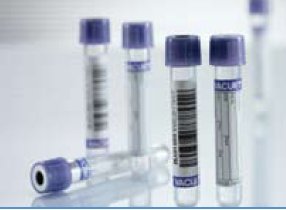 Greiner Bio-One VACUETTE® Venous Blood Collection Tube K2 EDTA Additive 13 X 75 mm 4 mL Lavender / Black Ring Pull Cap Polyethylene Terephthalate (PET) Tube - Pack of 50 - 454209-PK