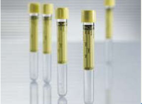 Greiner Bio-One VACUETTE® Urinalysis Tube Round Bottom Plain 13 X 100 mm 6.5 mL Yellow Screw Cap Polyethylene Terephthalate (PET) Tube - Case of 1200 - 456007-CS
