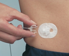 Medtronic Insulin Infusion Set Silhouette®Paradigm® 17 mm 43 Inch Tubing Without Port - Box of 10 - MMT-371-BX