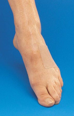 Creative Foam Corp Adhesive Dressing Moorebrand® 2 X 3 Inch Rectangle NonSterile - Pack of 1 - 900649-PK