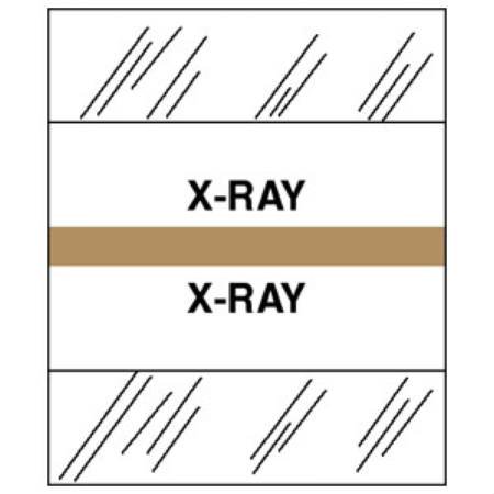 Tabbies Index Tab 1 1/4 Inch X-Ray - Pack of 100 - 54542-PK