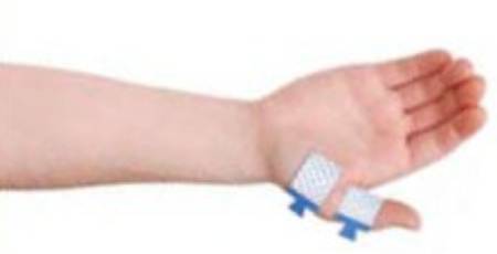 Natus Medical EMG Adhesive Electrode Kit Natus® Silver / Silver Chloride Sterile Bar Tab / Ring Tab / Ground Tab Tip Disposable - Each - N2025-EA